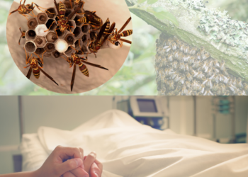 Meninggal Usai Disengat Tawon